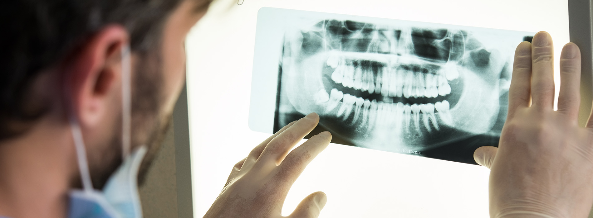 Middle Georgia Oral and Maxillofacial Surgery | Orthognathic Surgery, Oral Cancer Screening and Exposure of Impacted Teeth